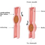 Irritable Bowel Syndrome, Gut Motility, and Probiotics