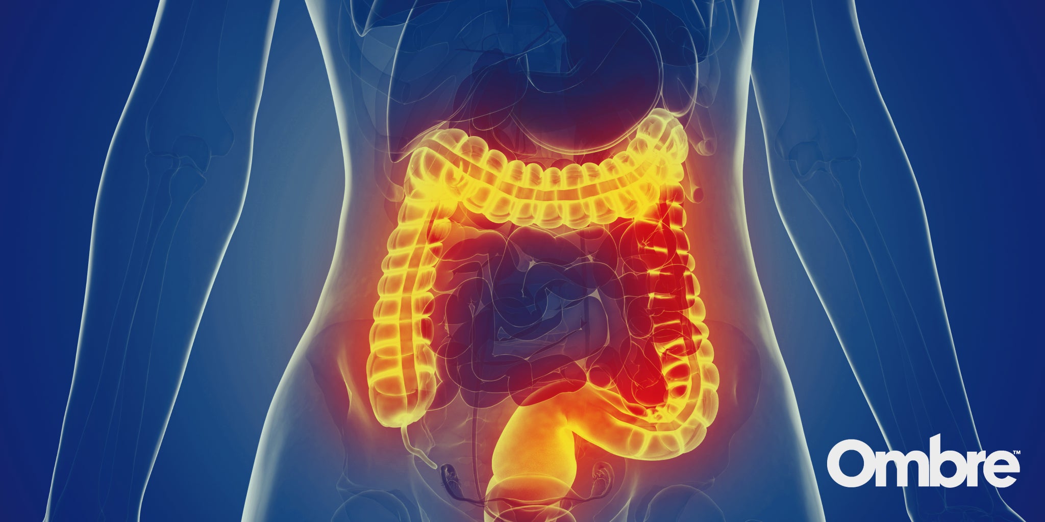 Diverticulitis: How to Heal A Large Intestine Infection